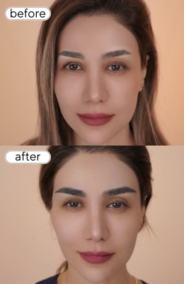 before-13