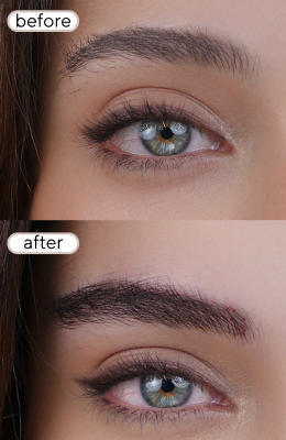 before-7