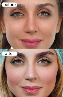 before-8